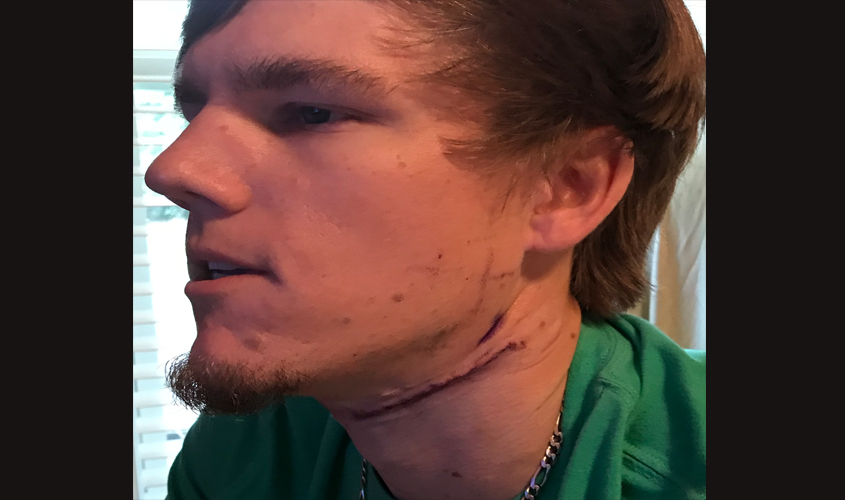 Latest Update on Walt Prince
