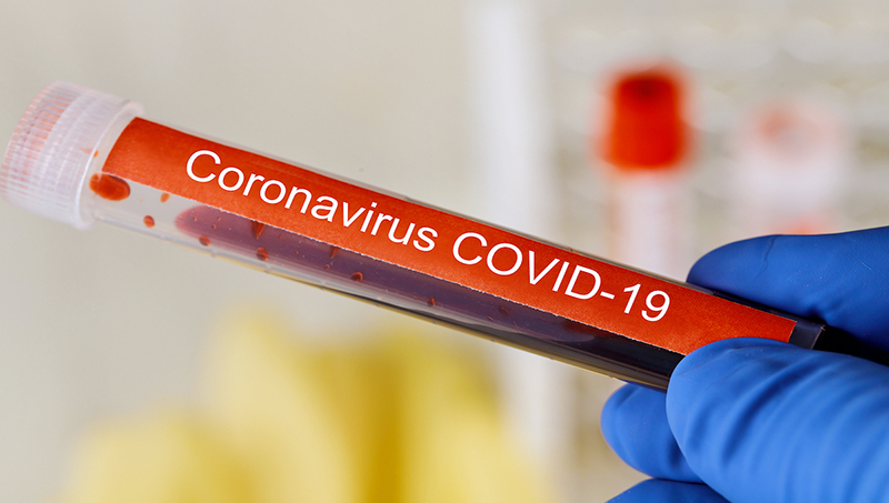 USDA won’t require meat and poultry testing for COVID-19